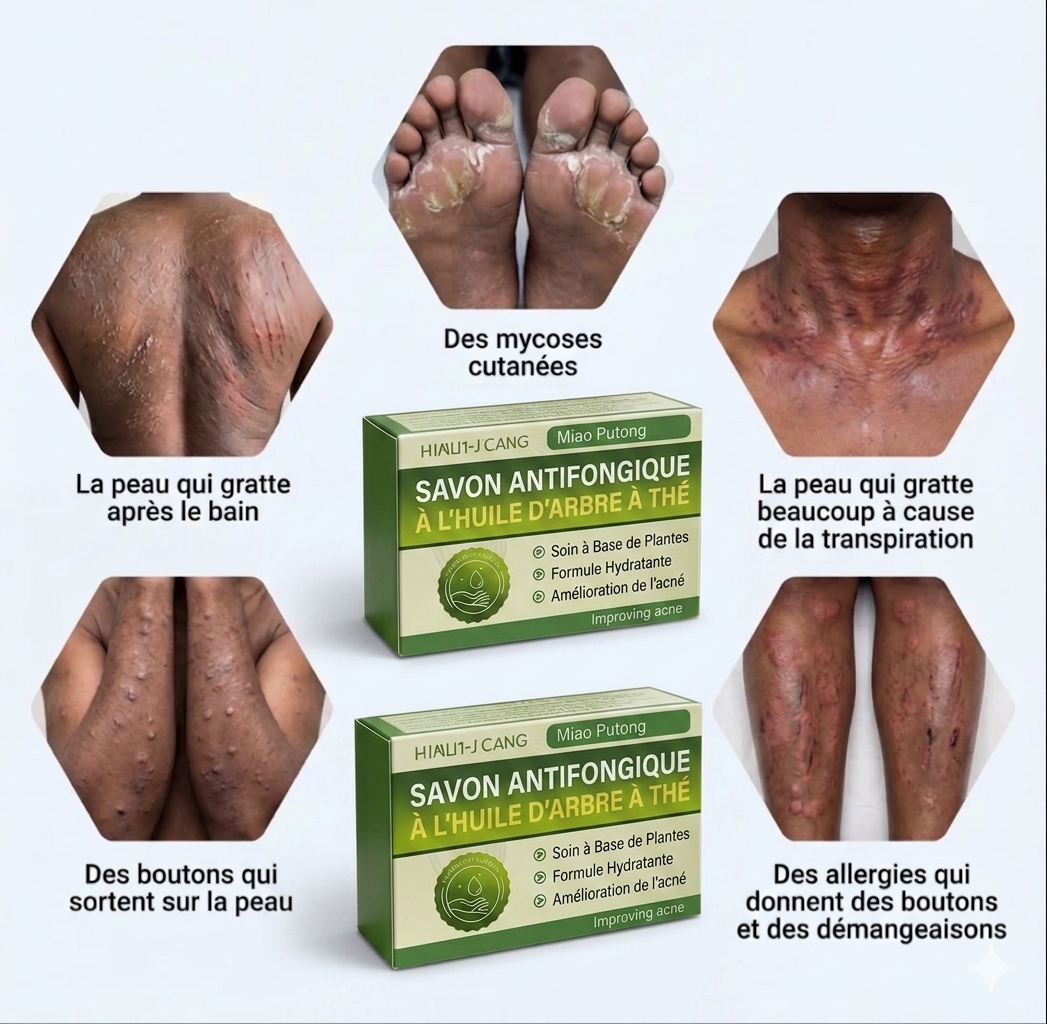 Savon Antifongique + Crème Antibactérienne Offerte -  Traitement Anti démangeaisons